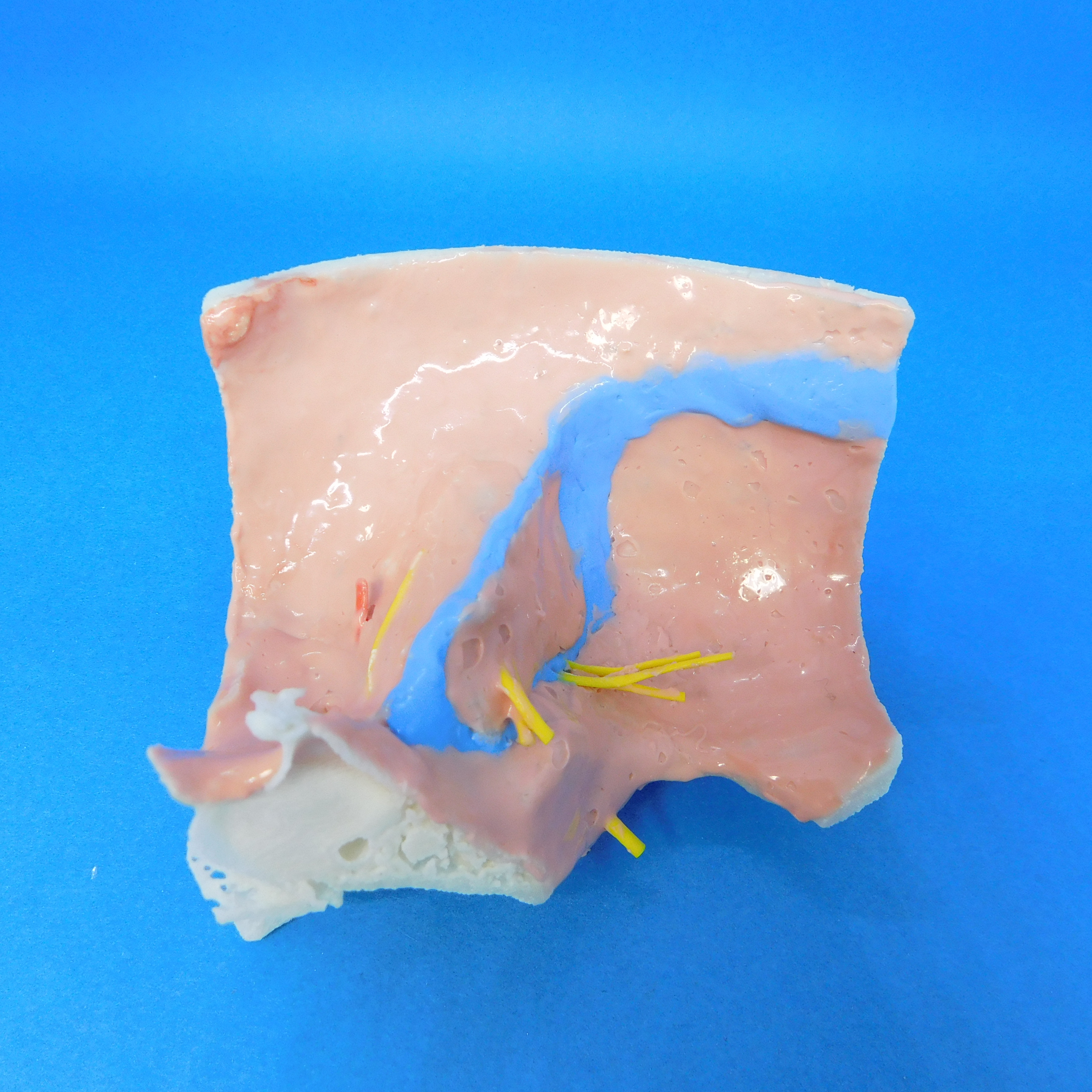 3D Printed Temporal Bone Models | KEZLEX