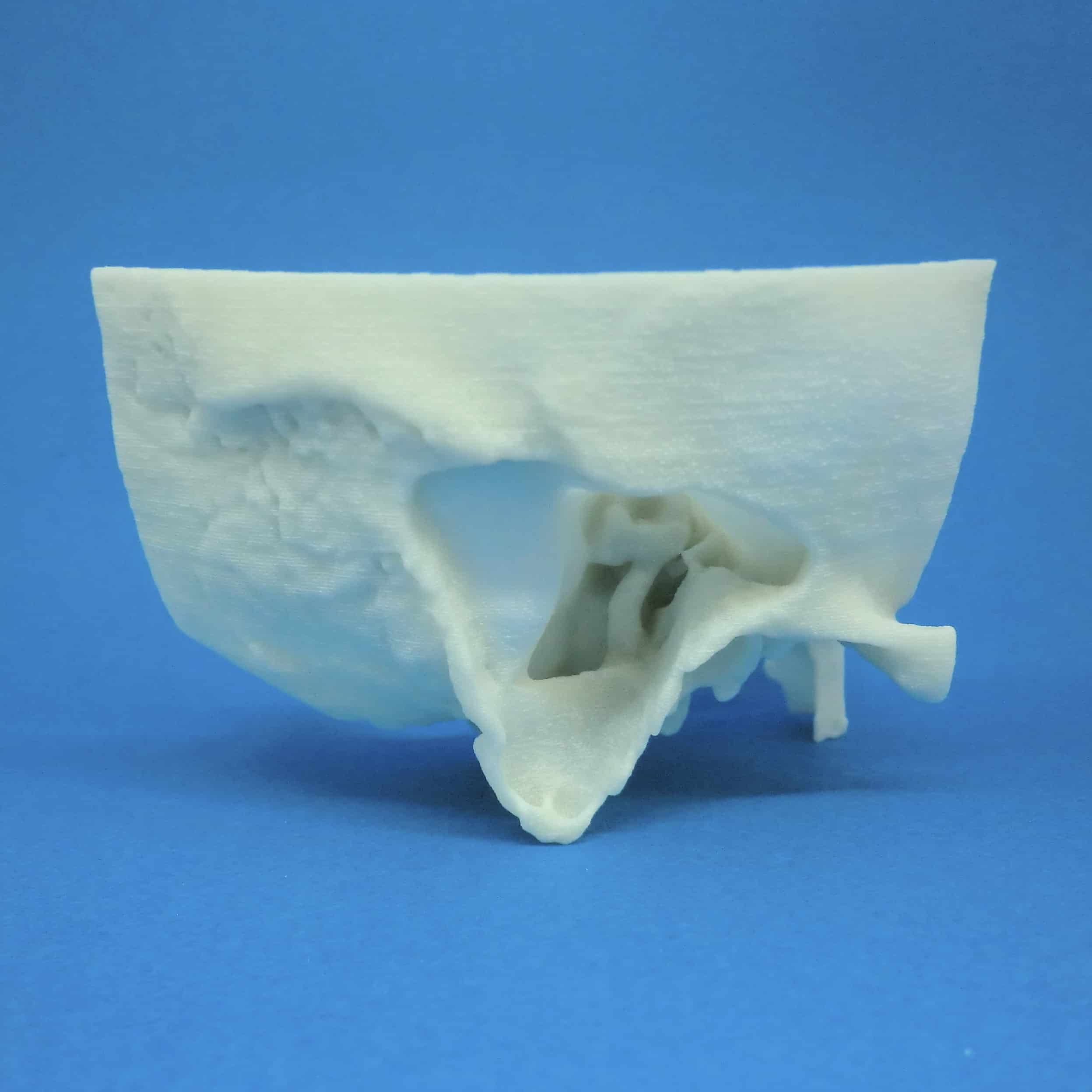 3D Printed Temporal Bone Models KEZLEX 3D Printed Temporal Bone Models KEZLEX