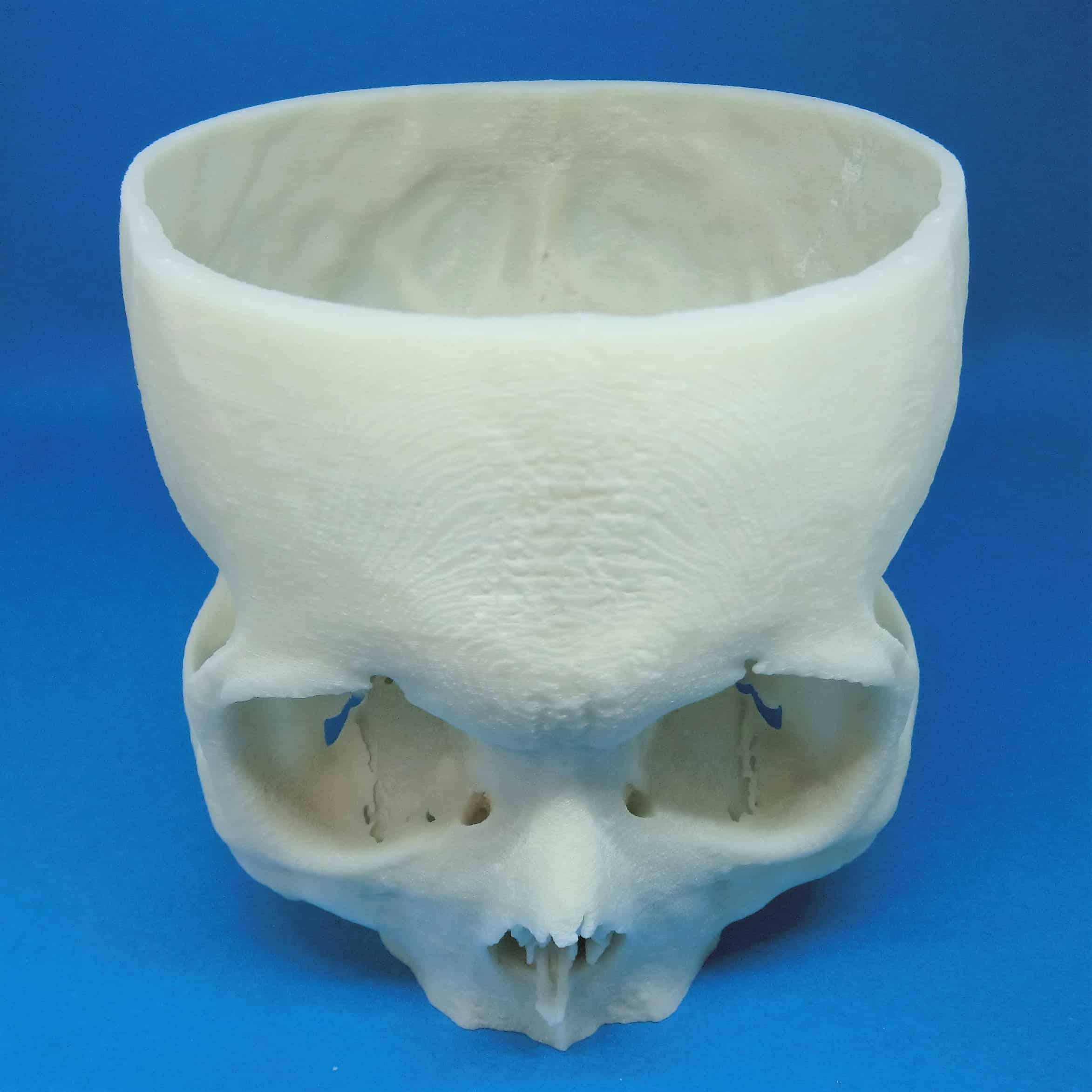100 000 Miniature Porcelain Skull3 – Fubiz Media