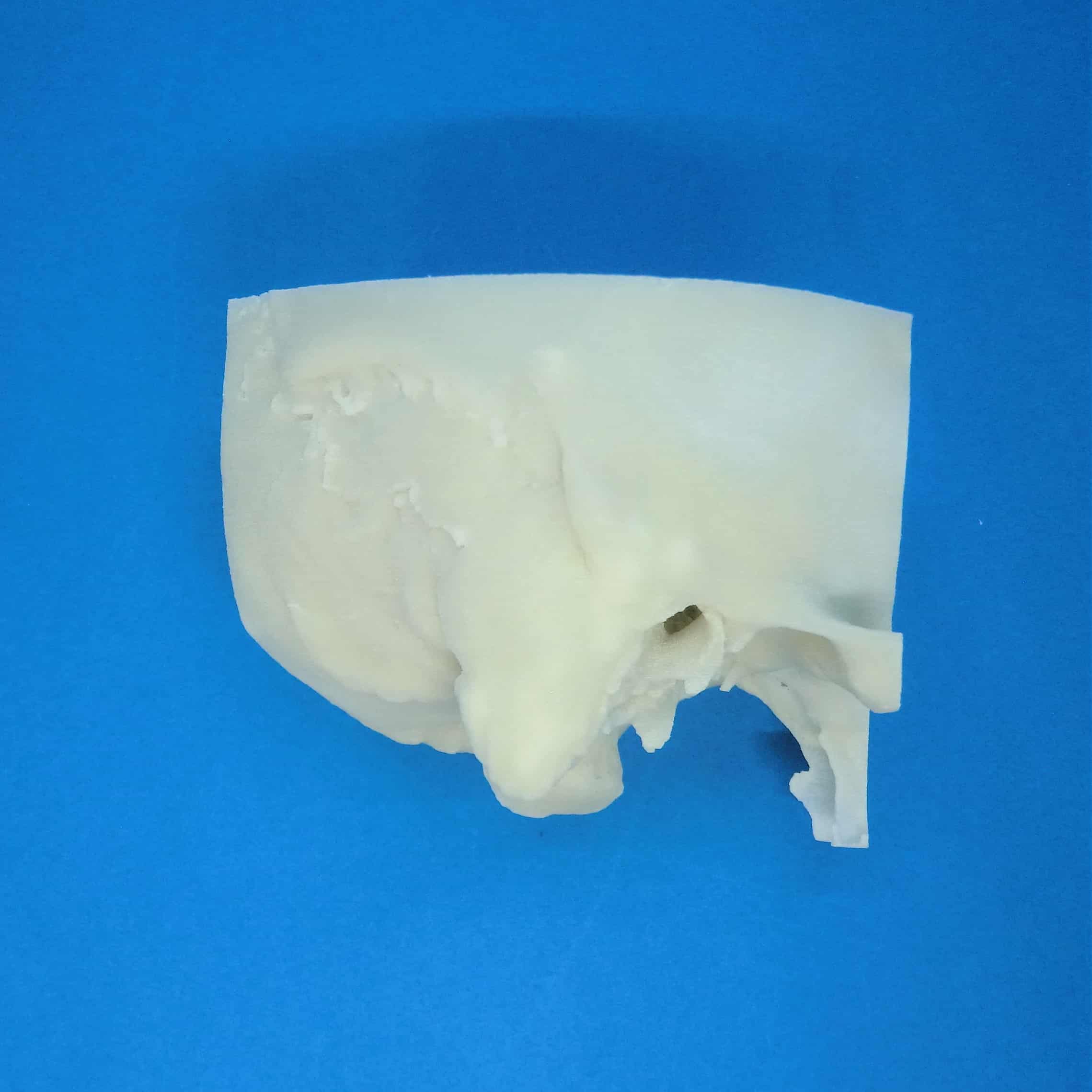 3D Printed Temporal Bone Models KEZLEX