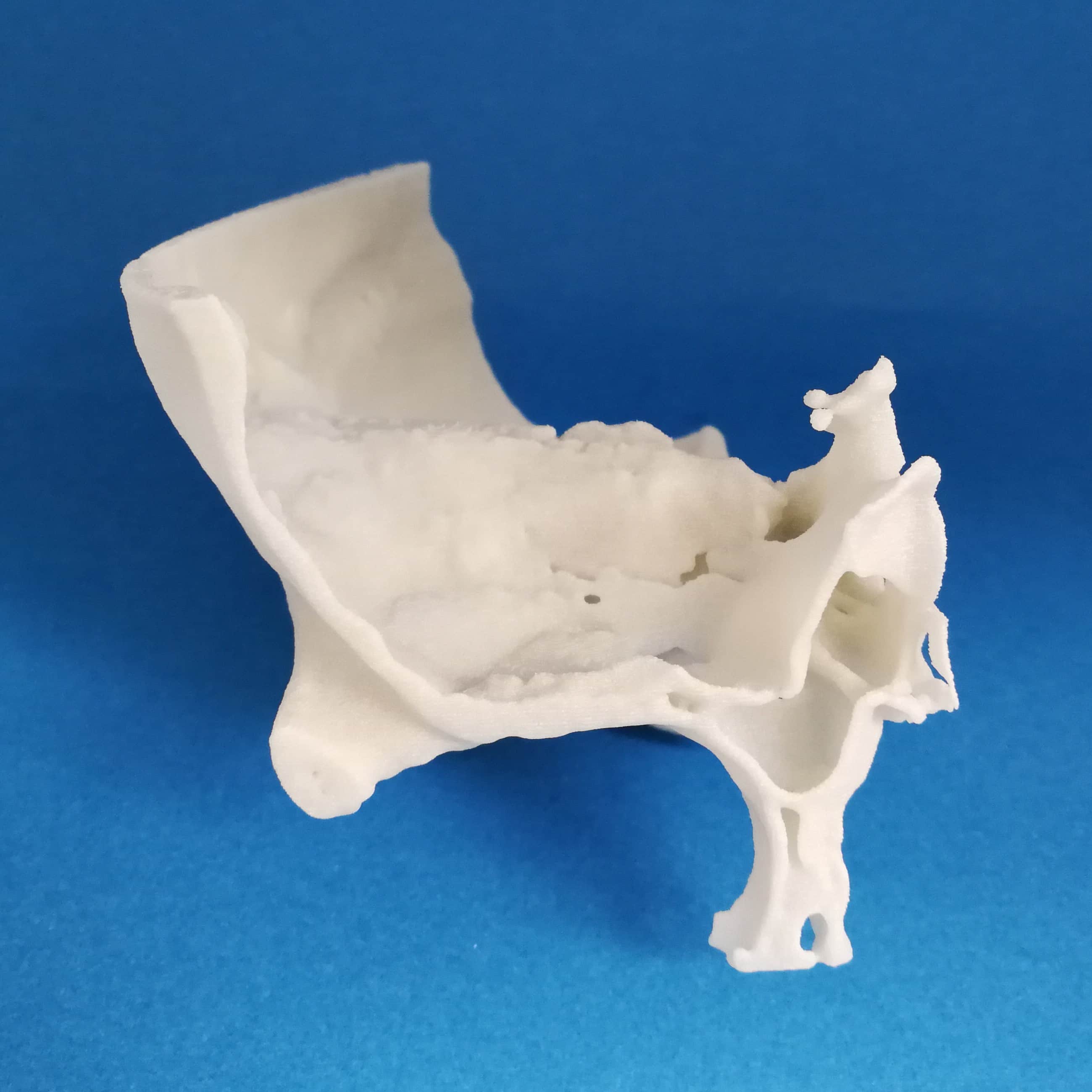 3D Printed W Temporal Bone Drilled 2 Model C12 2 KEZLEX 3D Printed W Temporal Bone Drilled 2 Model C12 2 KEZLEX